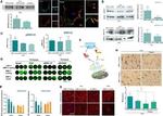 BMPR1A Antibody in Immunocytochemistry, Immunoprecipitation (ICC/IF, IP)