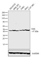 NSE Antibody in Western Blot (WB)