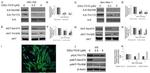 Phospho-ILK (Thr173) Antibody in Western Blot (WB)