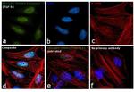 Phospho-SMAD2 (Ser118) Antibody in Immunocytochemistry (ICC/IF)