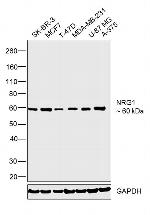 NRG1 Antibody in Western Blot (WB)