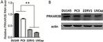 PRKAR2B Antibody in Western Blot (WB)