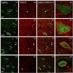 CaMKII alpha Antibody in Immunocytochemistry (ICC/IF)