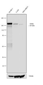 ErbB2 (HER-2) Antibody in Western Blot (WB)