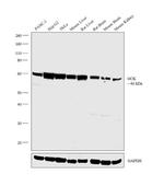 GCK Antibody in Western Blot (WB)