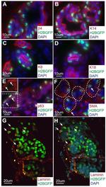 Laminin Antibody in Immunohistochemistry (IHC)