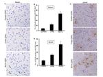 GFAP Antibody in Immunohistochemistry (IHC)