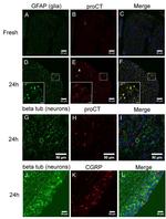 GFAP Antibody in Immunohistochemistry (IHC)