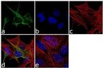 GFAP Antibody in Immunocytochemistry (ICC/IF)