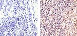 PARP1 Antibody in Immunohistochemistry (Paraffin) (IHC (P))