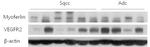 VEGF Receptor 2 Antibody in Western Blot (WB)