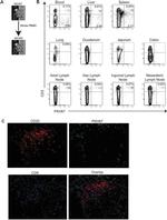 CD20 Antibody in Immunohistochemistry (IHC)