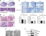 CD20 Antibody in Immunohistochemistry (IHC)