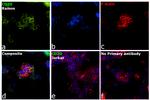 CD20 Antibody