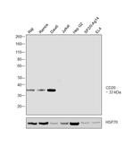 CD20 Antibody