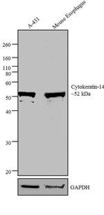 Cytokeratin 14 Antibody in Western Blot (WB)