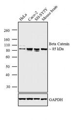 beta Catenin Antibody in Western Blot (WB)