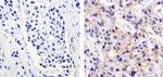 ErbB2 (HER-2) Antibody in Immunohistochemistry (Paraffin) (IHC (P))