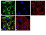 beta Tubulin Antibody in Immunocytochemistry (ICC/IF)