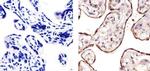 VEGF Receptor 3 Antibody in Immunohistochemistry (Paraffin) (IHC (P))