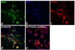 RRM1 Antibody in Immunocytochemistry (ICC/IF)