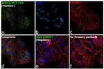 ACSL1 Antibody in Immunocytochemistry (ICC/IF)