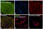 IGF2BP1 Antibody