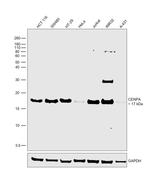 CENPA Antibody in Western Blot (WB)