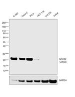 SOCS2 Antibody