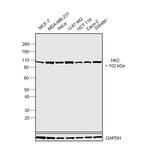 HK2 Antibody in Western Blot (WB)