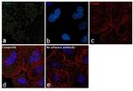 ITGB5 Antibody in Immunocytochemistry (ICC/IF)