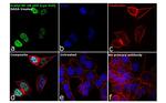 Acetyl-NFkB p65 (Lys310) Antibody in Immunocytochemistry (ICC/IF)