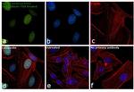 Acetyl-p53 (Lys379) Antibody