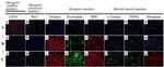 alpha Actinin 1 Antibody in Immunocytochemistry (ICC/IF)