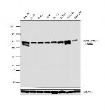 alpha Actinin 1 Antibody in Western Blot (WB)