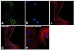 VE-cadherin Antibody in Immunocytochemistry (ICC/IF)