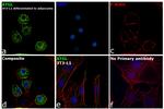 ATGL Antibody