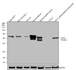 ATGL Antibody