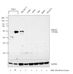 IRAK-M Antibody in Western Blot (WB)