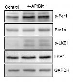 Phospho-MARK1/MARK2/MARK3 (Thr215, Thr208, Thr234) Antibody in Western Blot (WB)