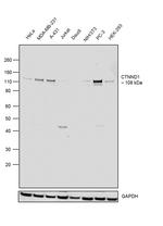 delta Catenin Antibody in Western Blot (WB)