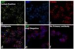 LAT Antibody in Immunocytochemistry (ICC/IF)