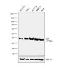 CK1 alpha Antibody in Western Blot (WB)