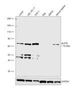 SLP76 Antibody in Western Blot (WB)