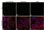 FAK Antibody in Immunocytochemistry (ICC/IF)