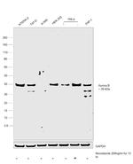 Aurora B Antibody in Western Blot (WB)