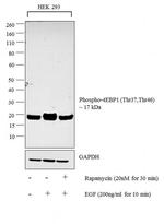 Phospho-4EBP1 (Thr37, Thr46) Antibody in Western Blot (WB)