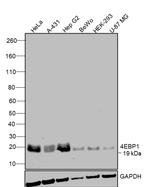 4EBP1 Antibody in Western Blot (WB)