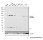 Cdc25B Antibody in Western Blot (WB)