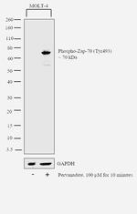 Phospho-Zap-70 (Tyr493) Antibody in Western Blot (WB)